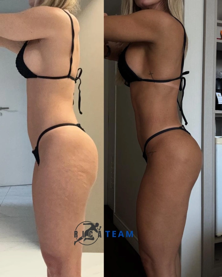 ricateam-antes-depois-01